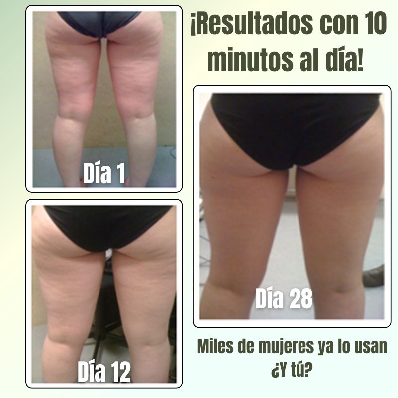 Despídete de la Celulitis, con 10 minutos al día ✨